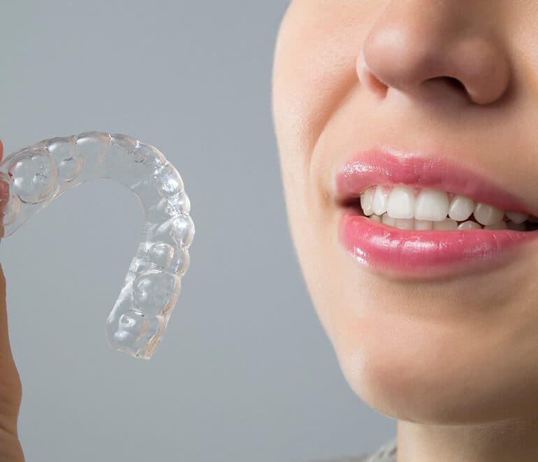 Invisalign